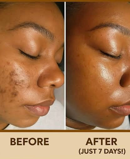 Dark spot corrector glow serum